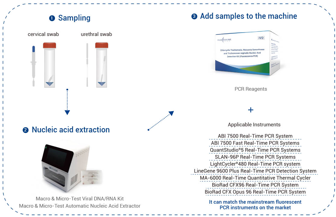 Kompleto por Detekto de Nukleaj Acidoj por Chlamydia Trachomatis, Neisseria Gonorrhoeae kaj Trichomonas vaginalis (Fluoreska PCR)
