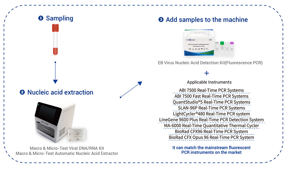 EB Virus Nucleic Acidum Detection Kit (Fluorescens PCR) 6