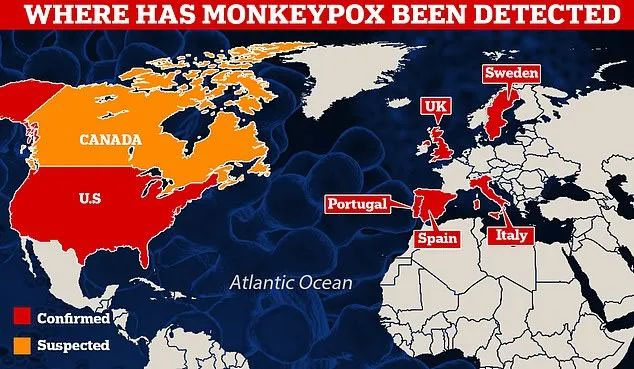 Macro & Micro-Test သည် monkeypox1 ကို လျင်မြန်စွာ စစ်ဆေးနိုင်စေပါသည်။