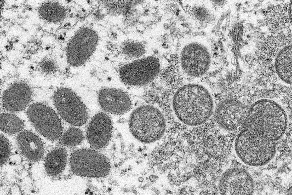 Macro & Micro-Test facilita a screening rapidu di Monkeypox2