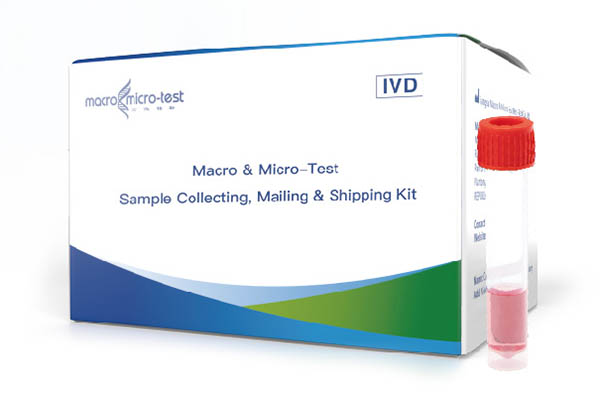 Macro & Micro-Test sensèman envite ou nan AACC3