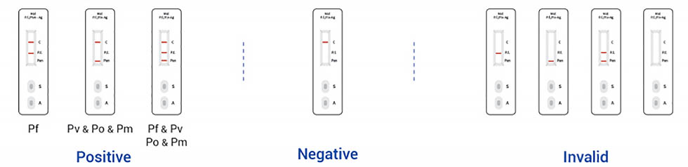 Plasmodium Antigen Detection Kit(Colloidal Gold) ၀၃