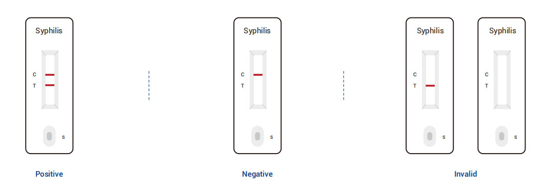 ການຕີຄວາມໝາຍຂອງຊຸດທົດສອບ TP Ab (ຄຳຄໍລອຍດອລ)