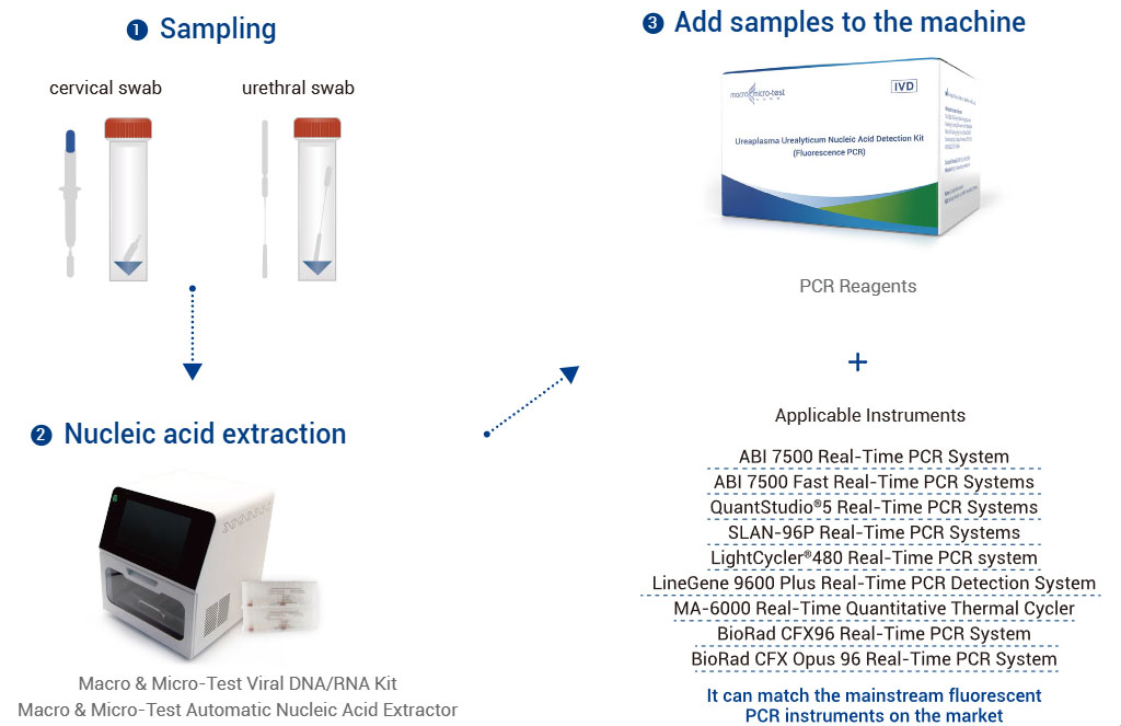 Ureaplasma Urealyticum Nukleïnezuurdeteksjekit (Fluoreszinsje PCR)
