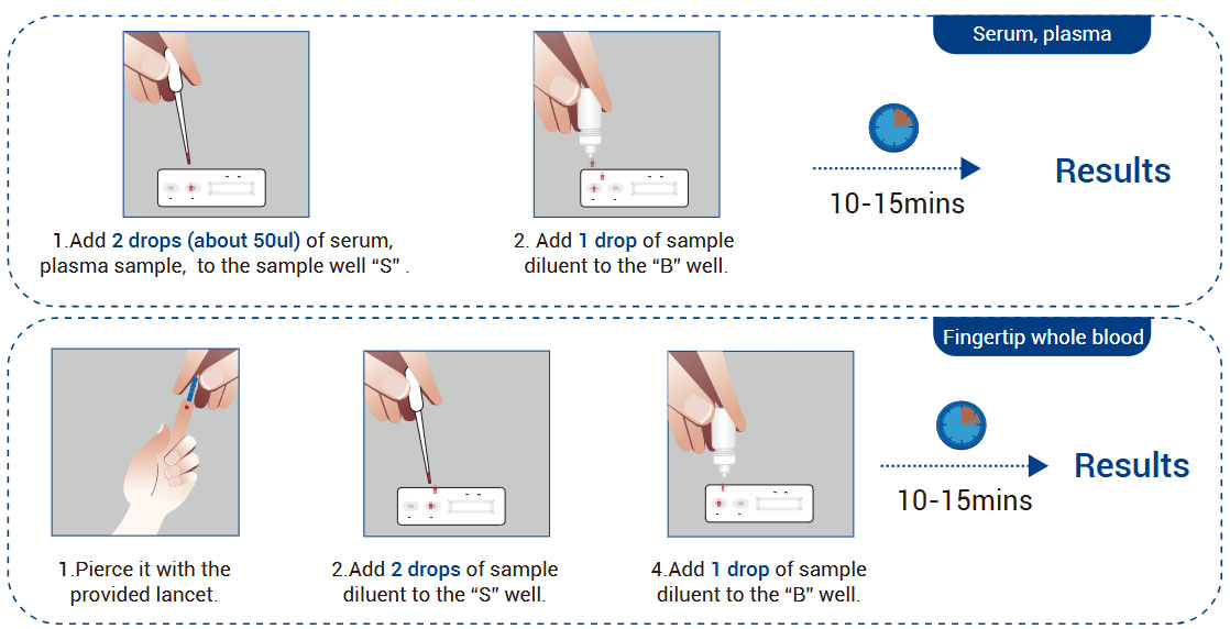 HIV 1 2 Ab Rapid Detection Kit (Colloidal Gold) Workflow