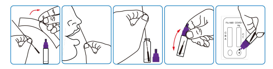 Nasopharyngeal swab sampling method